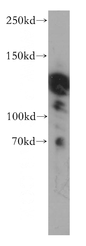 HeLa cells were subjected to SDS PAGE followed by western blot with Catalog No:107818(ABL2 antibody) at dilution of 1:500