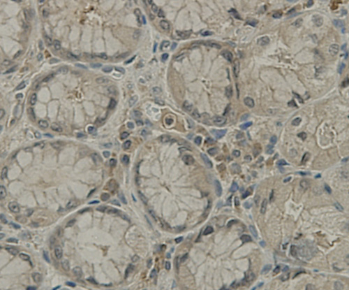 Fig7: Immunohistochemical analysis of paraffin-embedded hman stamoch tissue using anti-TMEM177 antibody. Counter stained with hematoxylin.