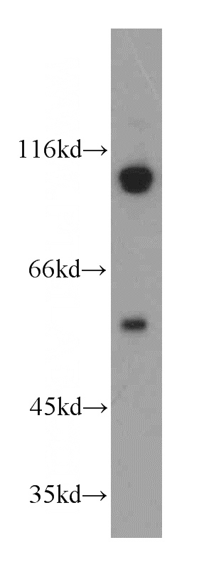 MCF7 cells were subjected to SDS PAGE followed by western blot with Catalog No:113649(PEG10 antibody) at dilution of 1:500