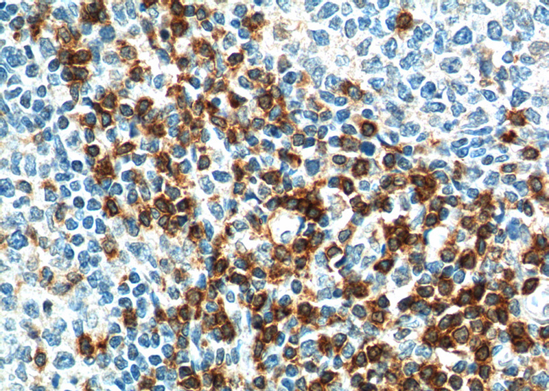 Immunohistochemistry of paraffin-embedded human tonsillitis tissue slide using Catalog No:116350(TRAT1 Antibody) at dilution of 1:100 (under 40x lens). heat mediated antigen retrieved with Tris-EDTA buffer(pH9).