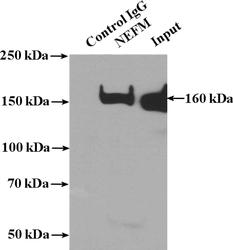 IP Result of anti-NEFM-Specific (IP:Catalog No:113163, 4ug; Detection:Catalog No:113163 1:1000) with rat brain tissue lysate 4000ug.