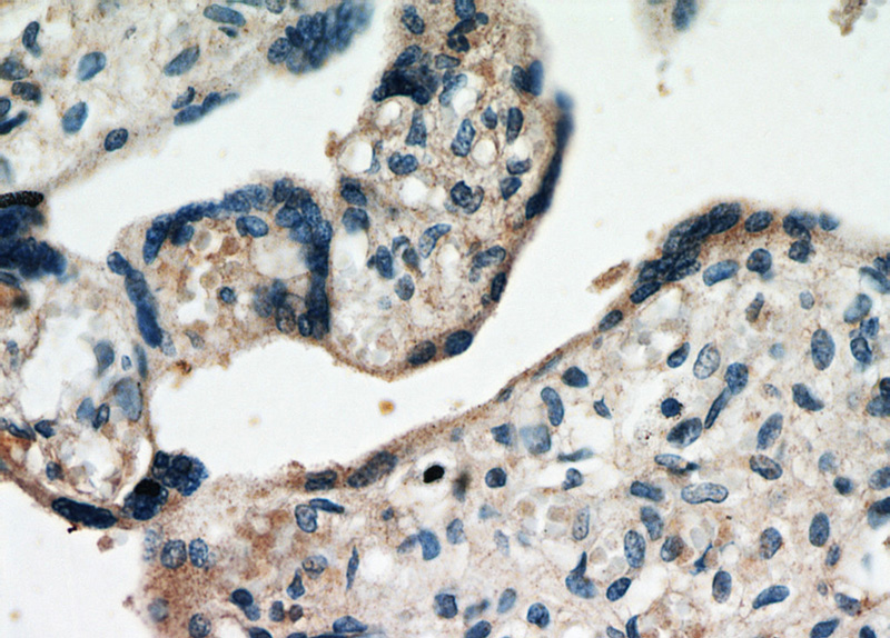 Immunohistochemical of paraffin-embedded human placenta using Catalog No:110600(FAM76A antibody) at dilution of 1:50 (under 40x lens)