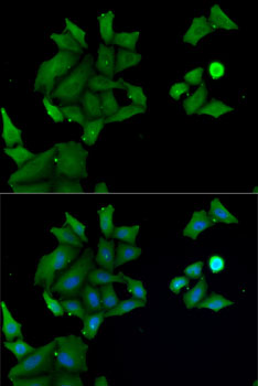 Immunofluorescence - HABP2 Polyclonal Antibody 