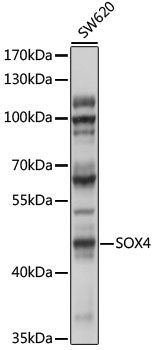 Western blot - SOX4 Polyclonal Antibody 