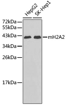 Western blot - mH2A2 Polyclonal Antibody 