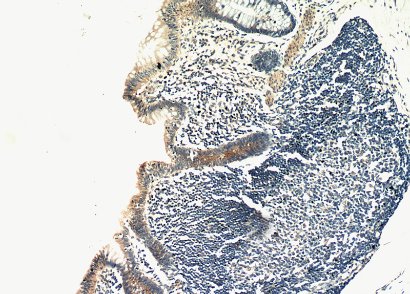 Immunohistochemical of paraffin-embedded human colon using Catalog No:108992(CCDC93 antibody) at dilution of 1:100 (under 10x lens)