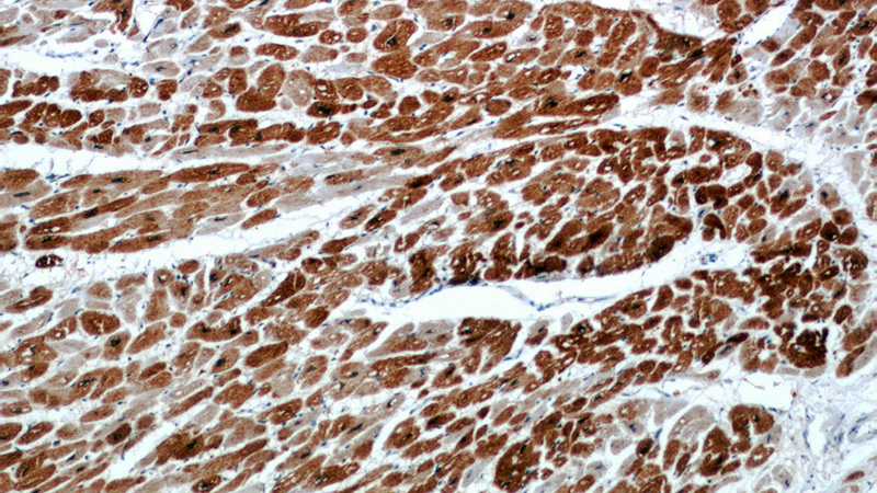 Immunohistochemical of paraffin-embedded human heart using Catalog No:111700(HSP27 antibody) at dilution of 1:50 (under 10x lens)