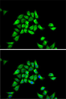 Immunofluorescence - DCTN1 Polyclonal Antibody 