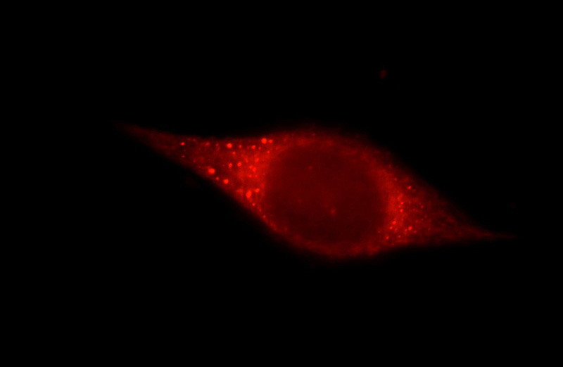 Immunofluorescent analysis of HeLa cells using Catalog No:111889(JMY Antibody) at dilution of 1:25 and Rhodamine-Goat anti-Rabbit IgG