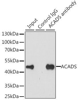 Immunoprecipitation - ACADS Polyclonal Antibody 