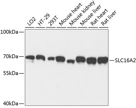 Western blot - SLC16A2 Polyclonal Antibody 