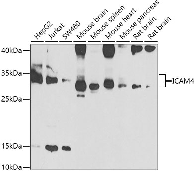 Western blot - ICAM4 Polyclonal Antibody 