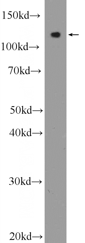 mouse brain tissue were subjected to SDS PAGE followed by western blot with Catalog No:114651(RGSL1 Antibody) at dilution of 1:600