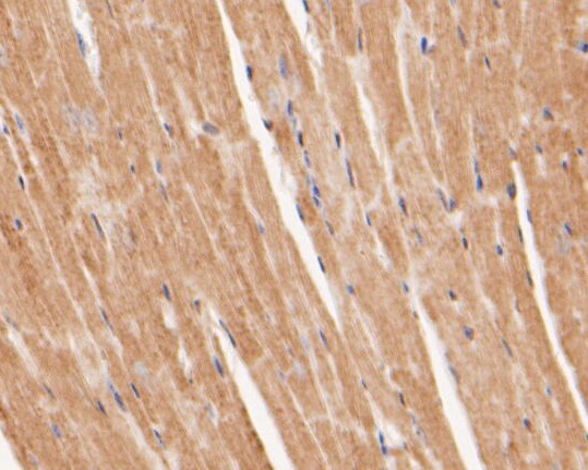Fig2:; Immunohistochemical analysis of paraffin-embedded mouse heart tissue using anti-Perilipin-5 antibody. The section was pre-treated using heat mediated antigen retrieval with Tris-EDTA buffer (pH 8.0-8.4) for 20 minutes.The tissues were blocked in 5% BSA for 30 minutes at room temperature, washed with ddH; 2; O and PBS, and then probed with the primary antibody ( 1/100) for 30 minutes at room temperature. The detection was performed using an HRP conjugated compact polymer system. DAB was used as the chromogen. Tissues were counterstained with hematoxylin and mounted with DPX.