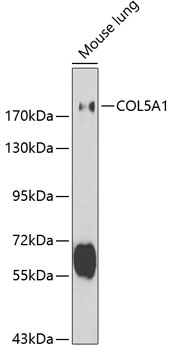 Western blot - COL5A1 Polyclonal Antibody 
