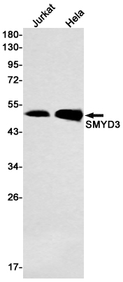 Western blot detection of SMYD3 in Jurkat,Hela cell lysates using SMYD3 Rabbit mAb(1:1000 diluted).Predicted band size:49kDa.Observed band size:49kDa.