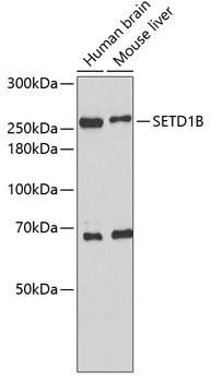 Western blot - SETD1B Polyclonal Antibody 
