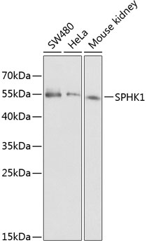 Western blot - SPHK1 Polyclonal Antibody 