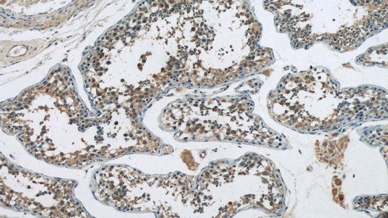 Immunohistochemistry of paraffin-embedded human testis tissue slide using Catalog No:116221(TPTE Antibody) at dilution of 1:50 (under 10x lens)