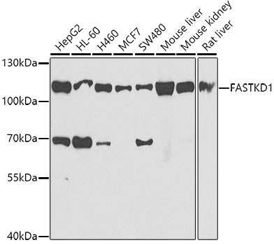 Western blot - FASTKD1 Polyclonal Antibody 