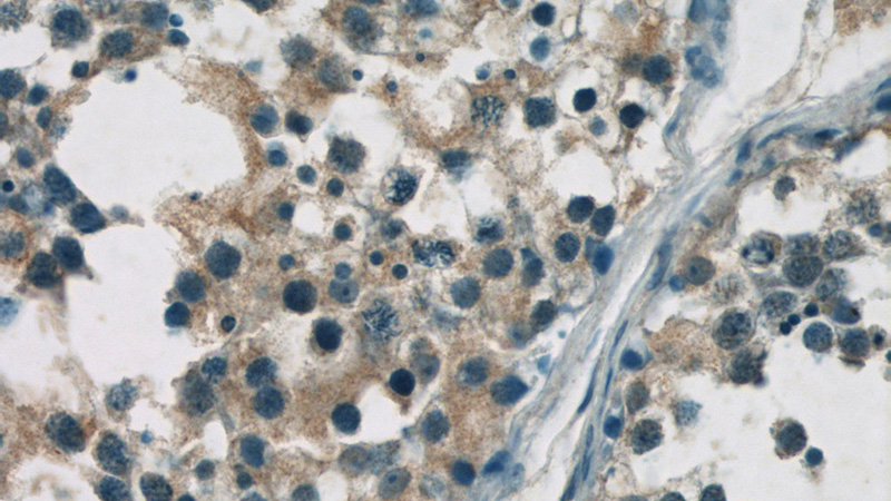 Immunohistochemistry of paraffin-embedded human testis tissue slide using Catalog No:117036(ZDHHC9 Antibody) at dilution of 1:50 (under 40x lens)