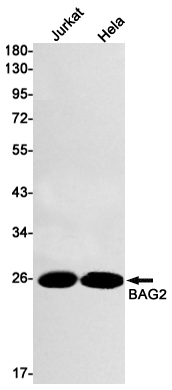 Western blot detection of BAG2 in Jurkat,Hela cell lysates using BAG2 Rabbit mAb(1:1000 diluted).Predicted band size:24kDa.Observed band size:24kDa.