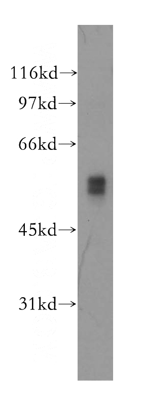 mouse lung tissue were subjected to SDS PAGE followed by western blot with Catalog No:109902(DFNA5 antibody) at dilution of 1:500