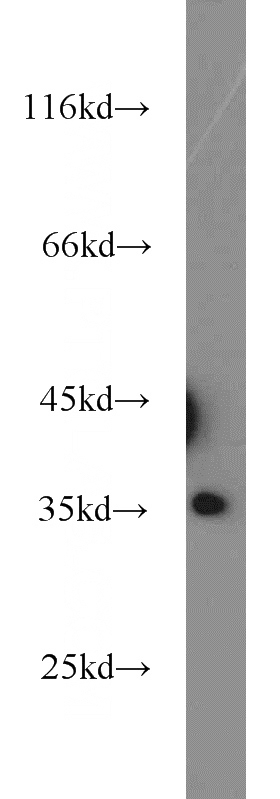 HEK-293 cells were subjected to SDS PAGE followed by western blot with Catalog No:114116(PPP4C antibody) at dilution of 1:1000