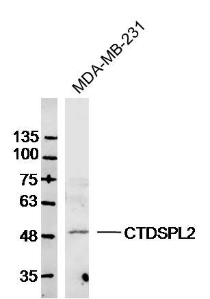 Fig1: Sample: MDA-MB-231 Cell (Human) Lysate at 30 ug; Primary: Anti-CTDSPL2 at 1/300 dilution; Secondary: IRDye800CW Goat Anti-Rabbit IgG at 1/20000 dilution; Predicted band size: 53kD; Observed band size: 53kD
