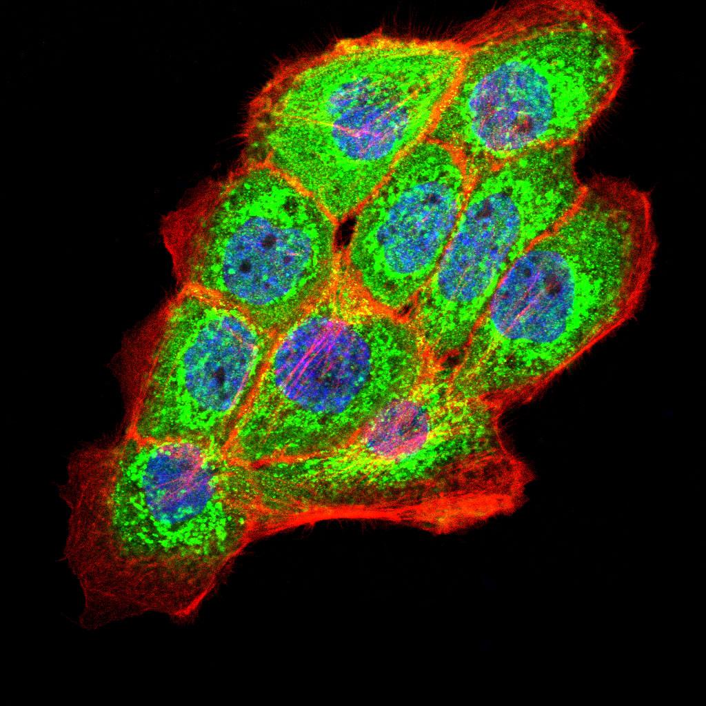 Fig2: ICC staining PKHD1 (green) and Actin filaments (red) in A431 cells. The nuclear counter stain is DAPI (blue). Cells were fixed in paraformaldehyde, permeabilised with 0.25% Triton X100/PBS.