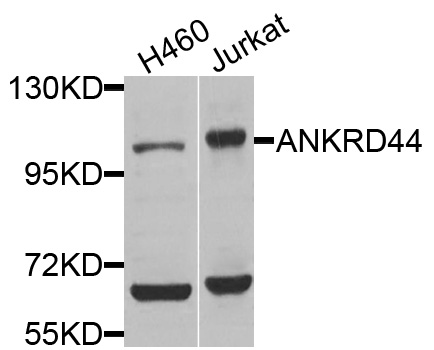 Western blot - ANKRD44 Polyclonal Antibody 