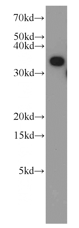 HEK-293 cells were subjected to SDS PAGE followed by western blot with Catalog No:116376(TTC1 antibody) at dilution of 1:500