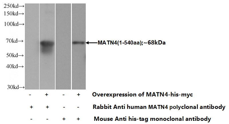 Transfected HEK-293 cells were subjected to SDS PAGE followed by western blot with Catalog No:112496(MATN4 Antibody) at dilution of 1:1000