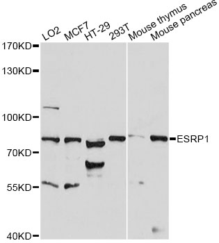 Western blot - ESRP1 Polyclonal Antibody 