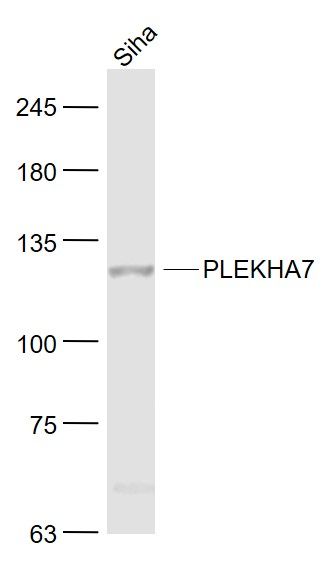 Fig1: Sample:; Siha(Human) Cell Lysate at 30 ug; Primary: Anti- PLEKHA7 at 1/1000 dilution; Secondary: IRDye800CW Goat Anti-Rabbit IgG at 1/20000 dilution; Predicted band size: 127 kD; Observed band size: 127 kD