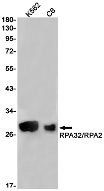 Western blot detection of RPA32/RPA2 in K562,C6 cell lysates using RPA32/RPA2 Rabbit pAb(1:1000 diluted).Predicted band size:29kDa.Observed band size:29kDa.