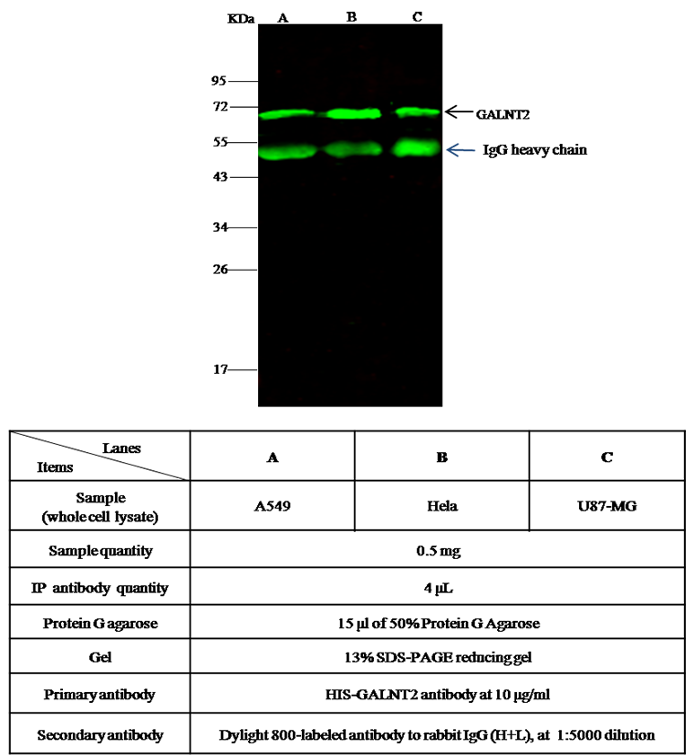 Human GALNT2 / GalNAc-T2 Immunoprecipitation(IP) 15677