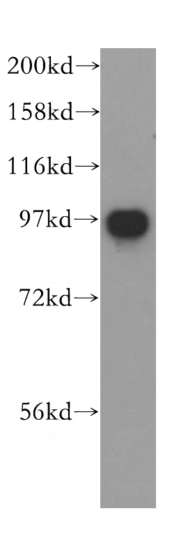 human liver tissue were subjected to SDS PAGE followed by western blot with Catalog No:116794(VPS53 antibody) at dilution of 1:300