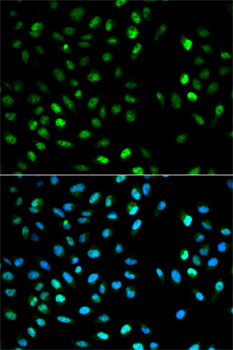 Immunofluorescence - DTNBP1 Polyclonal Antibody 