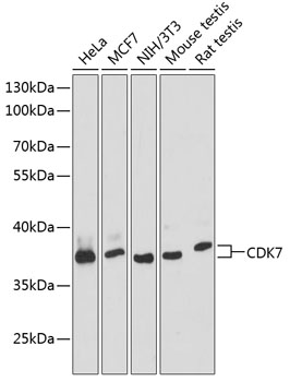Western blot - CDK7 Polyclonal Antibody 