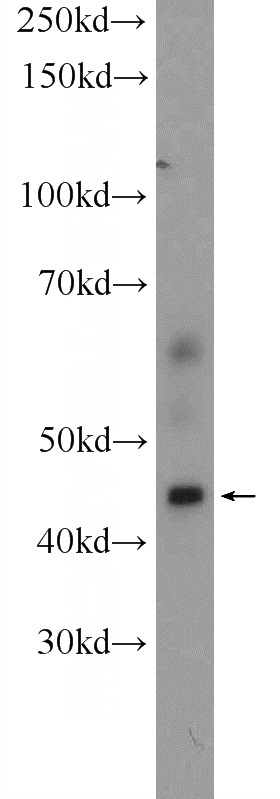 HeLa cells were subjected to SDS PAGE followed by western blot with Catalog No:113546(P2RY13 Antibody) at dilution of 1:300