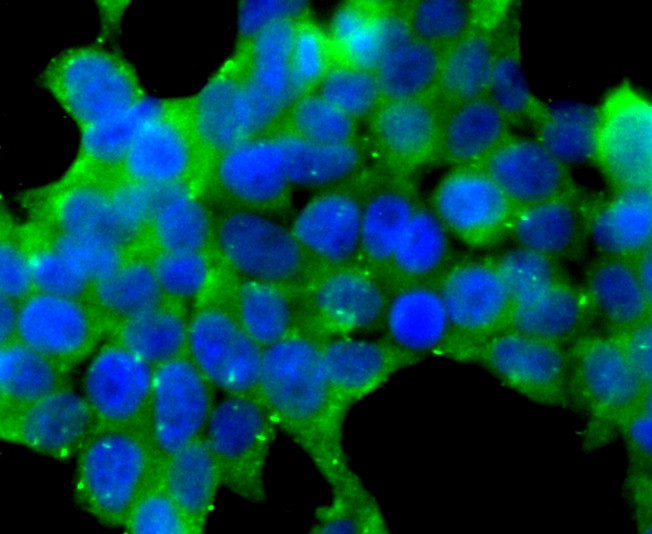 Fig4: ICC staining TGM6 in 293T cells (green). The nuclear counter stain is DAPI (blue). Cells were fixed in paraformaldehyde, permeabilised with 0.25% Triton X100/PBS.