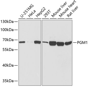 Western blot - PGM1 Polyclonal Antibody 