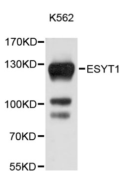Western blot - ESYT1 Polyclonal Antibody 