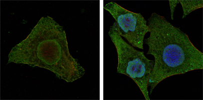 Confocal immunofluorescence analysis of MCF-7 (left) and HepG2 (right) cells using BRAF mouse mAb (green). Red