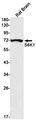 Western blot detection of S6K1 in Rat Brain lysates using S6K1 Rabbit mAb(1:1000 diluted).Predicted band size:59kDa.Observed band size:70kDa.