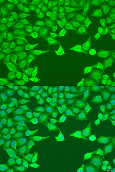 Immunofluorescence - ATG9A Polyclonal Antibody 