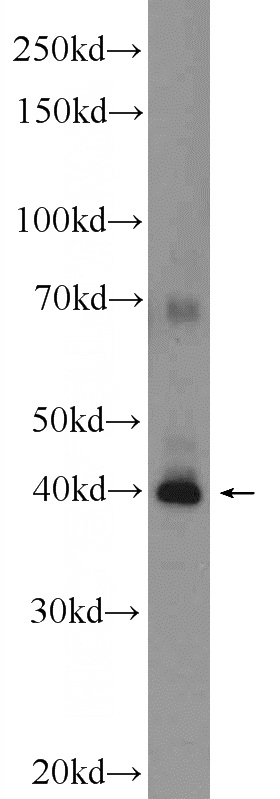 HeLa cells were subjected to SDS PAGE followed by western blot with Catalog No:115292(SLAIN1 Antibody) at dilution of 1:600