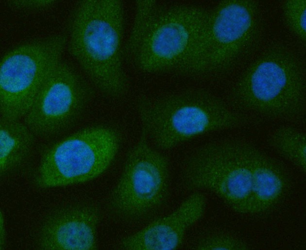 Fig4: ICC staining NRCAM in SKOV-3 cells (green). The nuclear counter stain is DAPI (blue). Cells were fixed in paraformaldehyde, permeabilised with 0.25% Triton X100/PBS.