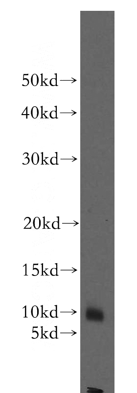 mouse pancreas tissue were subjected to SDS PAGE followed by western blot with Catalog No:115697(STATH antibody) at dilution of 1:300